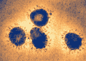 E.M. of SARS-CoV Particles